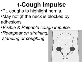 1-Cough Impulse
•Pt. coughs to highlight hernia.
•May not ;if the neck is blocked by
adhesions
•Visible & Palpable cough impulse.
•Reappear on straining,
standing or coughing
 
