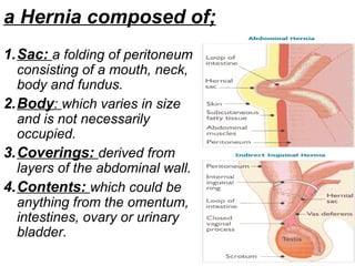 a Hernia composed of;
1.Sac: a folding of peritoneum
consisting of a mouth, neck,
body and fundus.
2.Body: which varies in size
and is not necessarily
occupied.
3.Coverings: derived from
layers of the abdominal wall.
4.Contents: which could be
anything from the omentum,
intestines, ovary or urinary
bladder.
 