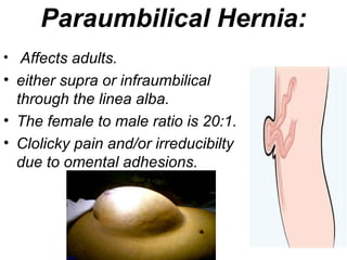 Paraumbilical Hernia:
• Affects adults.
• either supra or infraumbilical
through the linea alba.
• The female to male ratio is 20:1.
• Clolicky pain and/or irreducibilty
due to omental adhesions.
 