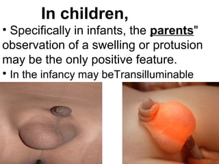 In children,
• Specifically in infants, the parents"
observation of a swelling or protusion
may be the only positive feature.
• In the infancy may beTransilluminable
 