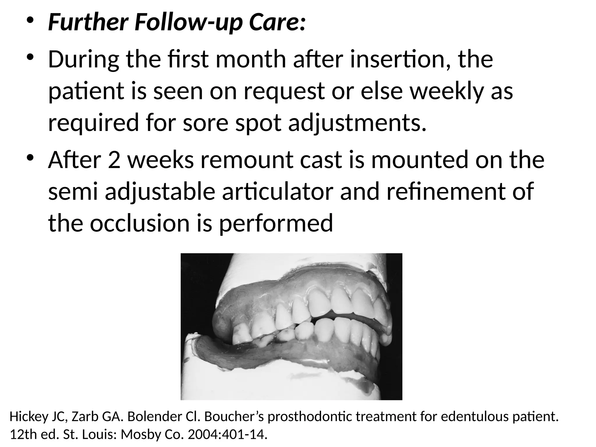 • Further Follow-up Care:
• During the first month after insertion, the
patient is seen on request or else weekly as
required for sore spot adjustments.
• After 2 weeks remount cast is mounted on the
semi adjustable articulator and refinement of
the occlusion is performed
Hickey JC, Zarb GA. Bolender Cl. Boucher’s prosthodontic treatment for edentulous patient.
12th ed. St. Louis: Mosby Co. 2004:401-14.
 