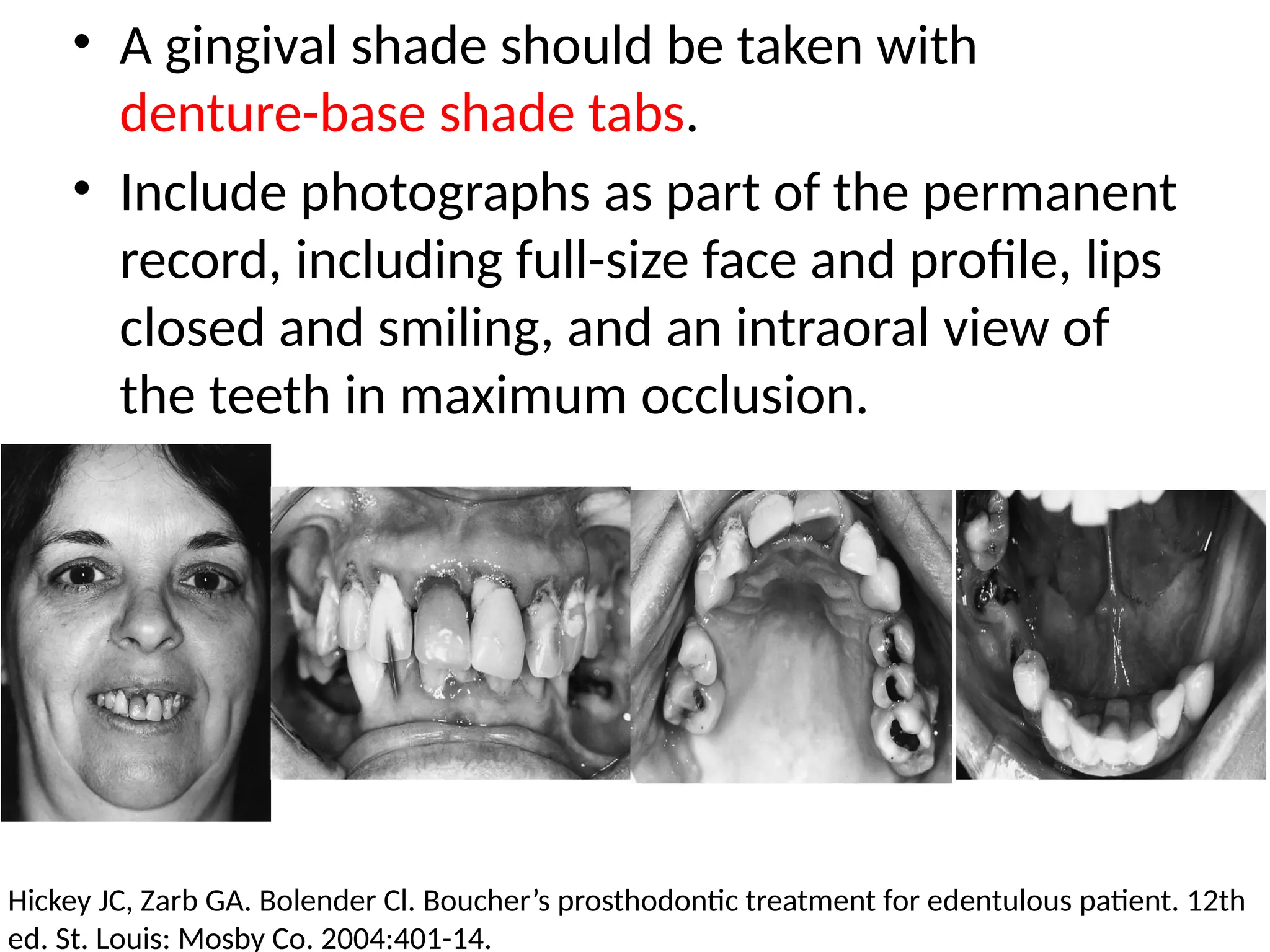 • A gingival shade should be taken with
denture-base shade tabs.
• Include photographs as part of the permanent
record, including full-size face and profile, lips
closed and smiling, and an intraoral view of
the teeth in maximum occlusion.
Hickey JC, Zarb GA. Bolender Cl. Boucher’s prosthodontic treatment for edentulous patient. 12th
ed. St. Louis: Mosby Co. 2004:401-14.
 