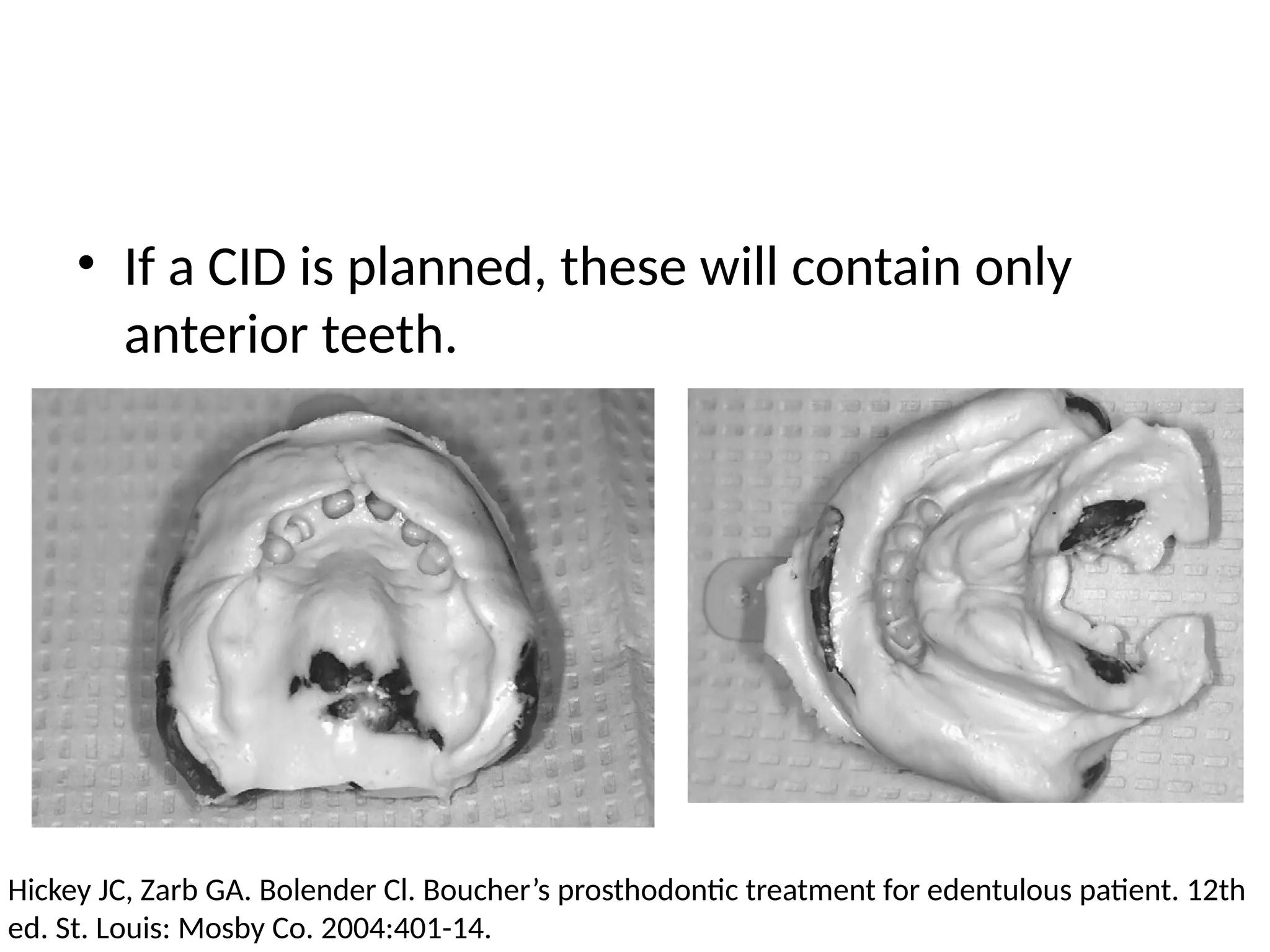 • If a CID is planned, these will contain only
anterior teeth.
Hickey JC, Zarb GA. Bolender Cl. Boucher’s prosthodontic treatment for edentulous patient. 12th
ed. St. Louis: Mosby Co. 2004:401-14.
 