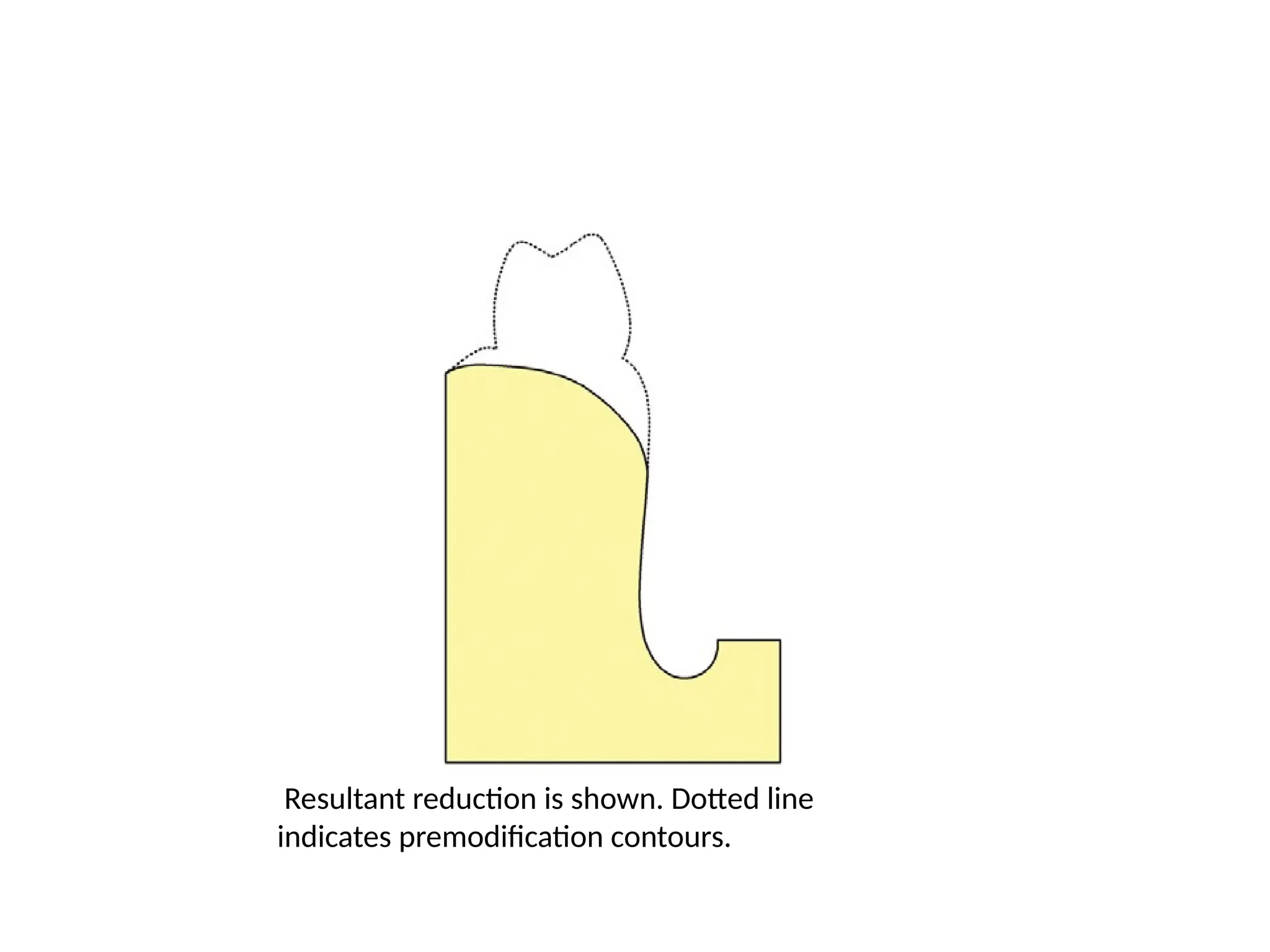 Resultant reduction is shown. Dotted line
indicates premodification contours.
 