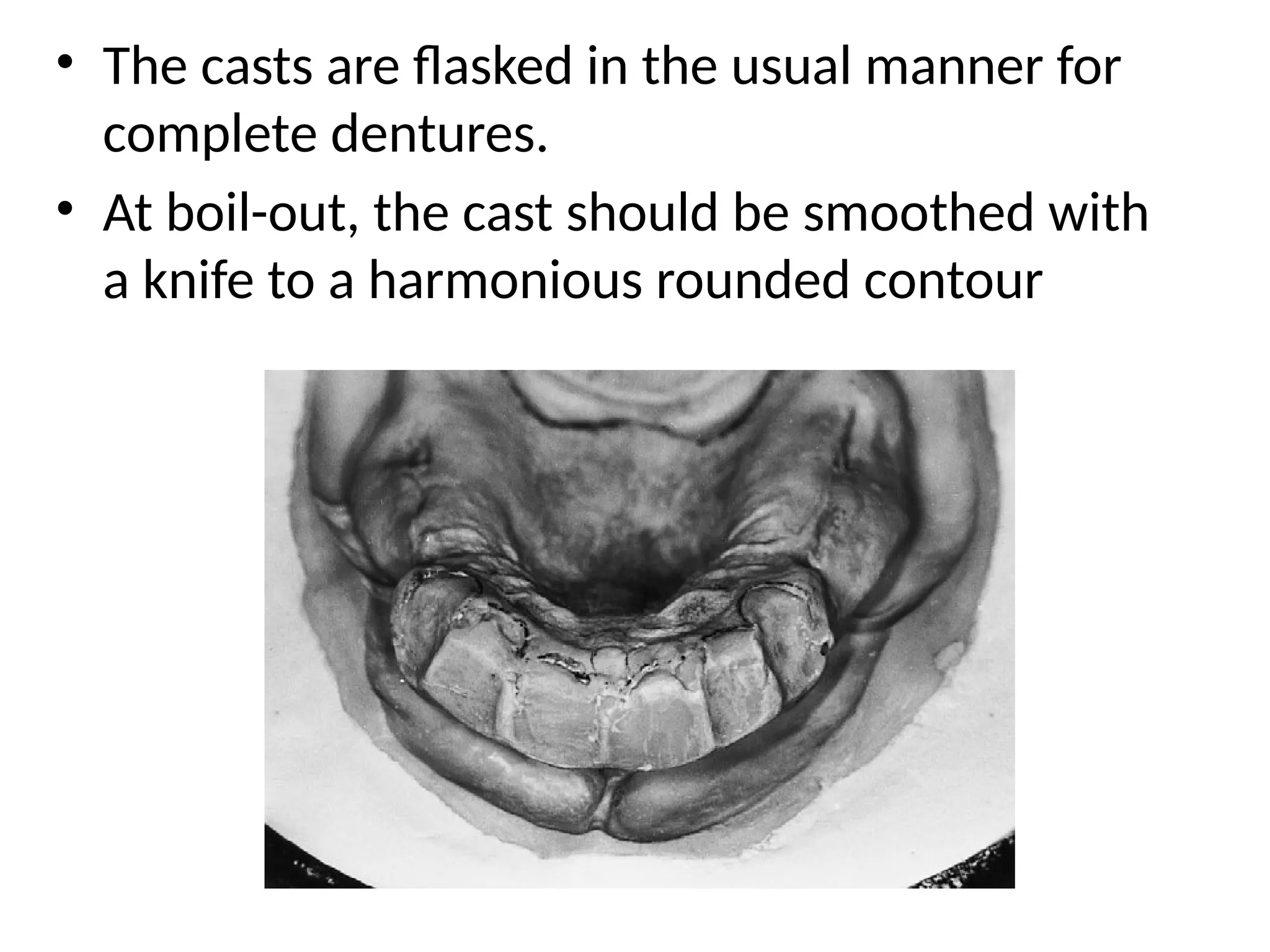 • The casts are flasked in the usual manner for
complete dentures.
• At boil-out, the cast should be smoothed with
a knife to a harmonious rounded contour
 