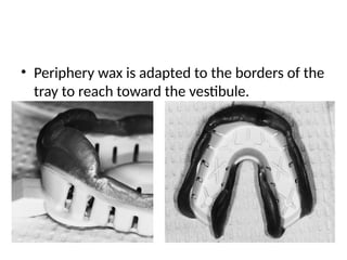 • Periphery wax is adapted to the borders of the
tray to reach toward the vestibule.
 