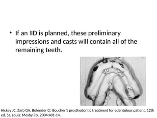 • If an IID is planned, these preliminary
impressions and casts will contain all of the
remaining teeth.
Hickey JC, Zarb GA. Bolender Cl. Boucher’s prosthodontic treatment for edentulous patient. 12th
ed. St. Louis: Mosby Co. 2004:401-14.
 