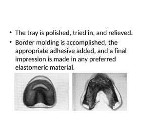 • The tray is polished, tried in, and relieved.
• Border molding is accomplished, the
appropriate adhesive added, and a final
impression is made in any preferred
elastomeric material.
 