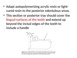 • Adapt autopolymerizing acrylic resin or light-
cured resin to the posterior edentulous areas.
• This section or posterior tray should cover the
lingual surfaces of the teeth and extend up
beyond the incisal edges of the teeth to
include a handle
 