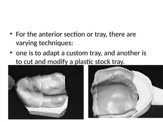 • For the anterior section or tray, there are
varying techniques:
• one is to adapt a custom tray, and another is
to cut and modify a plastic stock tray.
 