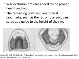 • Wax occlusion rims are added to the proper
height and width.
• The remaining teeth and anatomical
landmarks, such as the retromolar pad, can
serve as a guide to the height of the rim.
Hickey JC, Zarb GA. Bolender Cl. Boucher’s prosthodontic treatment for edentulous patient. 12th
ed. St. Louis: Mosby Co. 2004:401-14.
 