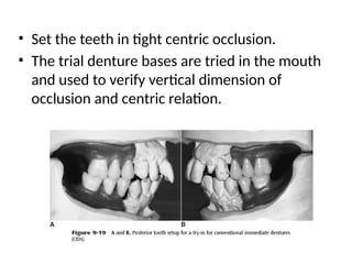 • Set the teeth in tight centric occlusion.
• The trial denture bases are tried in the mouth
and used to verify vertical dimension of
occlusion and centric relation.
 