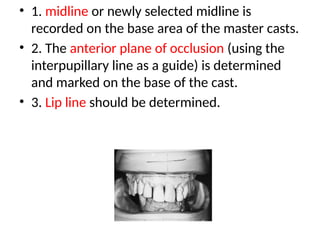 • 1. midline or newly selected midline is
recorded on the base area of the master casts.
• 2. The anterior plane of occlusion (using the
interpupillary line as a guide) is determined
and marked on the base of the cast.
• 3. Lip line should be determined.
 