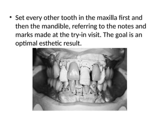 • Set every other tooth in the maxilla first and
then the mandible, referring to the notes and
marks made at the try-in visit. The goal is an
optimal esthetic result.
 