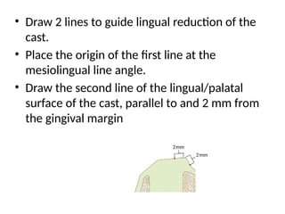 • Draw 2 lines to guide lingual reduction of the
cast.
• Place the origin of the first line at the
mesiolingual line angle.
• Draw the second line of the lingual/palatal
surface of the cast, parallel to and 2 mm from
the gingival margin
 