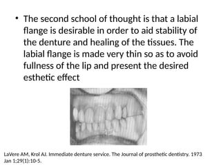 • The second school of thought is that a labial
flange is desirable in order to aid stability of
the denture and healing of the tissues. The
labial flange is made very thin so as to avoid
fullness of the lip and present the desired
esthetic effect
LaVere AM, Krol AJ. Immediate denture service. The Journal of prosthetic dentistry. 1973
Jan 1;29(1):10-5.
 
