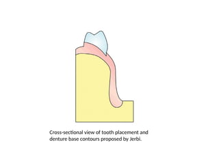 Cross-sectional view of tooth placement and
denture base contours proposed by Jerbi.
 