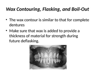 Wax Contouring, Flasking, and Boil-Out
• The wax contour is similar to that for complete
dentures
• Make sure that wax is added to provide a
thickness of material for strength during
future deflasking.
 