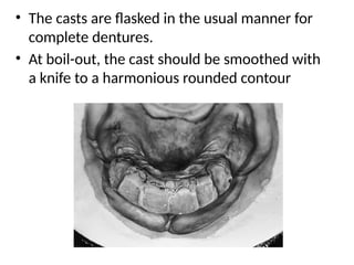 • The casts are flasked in the usual manner for
complete dentures.
• At boil-out, the cast should be smoothed with
a knife to a harmonious rounded contour
 
