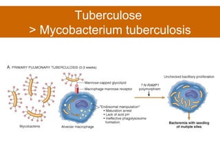 Tuberculose  > Mycobacterium tuberculosis 
