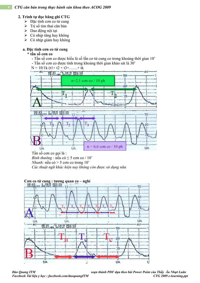 CTG CĂN BẢN TRONG THỰC HÀNH SẢN KHOA ACOG 2009 | PDF