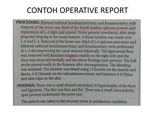 CONTOH OPERATIVE REPORT
 