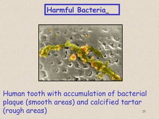 Harmful Bacteria




Human tooth with accumulation of bacterial
plaque (smooth areas) and calcified tartar
(rough areas)                              23
 