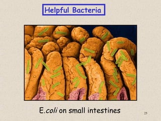 Helpful Bacteria




E.coli on small intestines   25
 