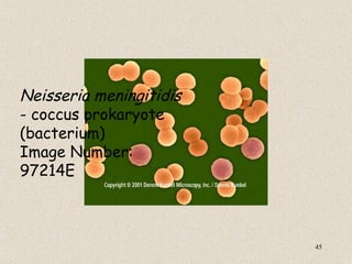 Neisseria meningitidis
- coccus prokaryote
(bacterium)
Image Number:
97214E



                         45
 