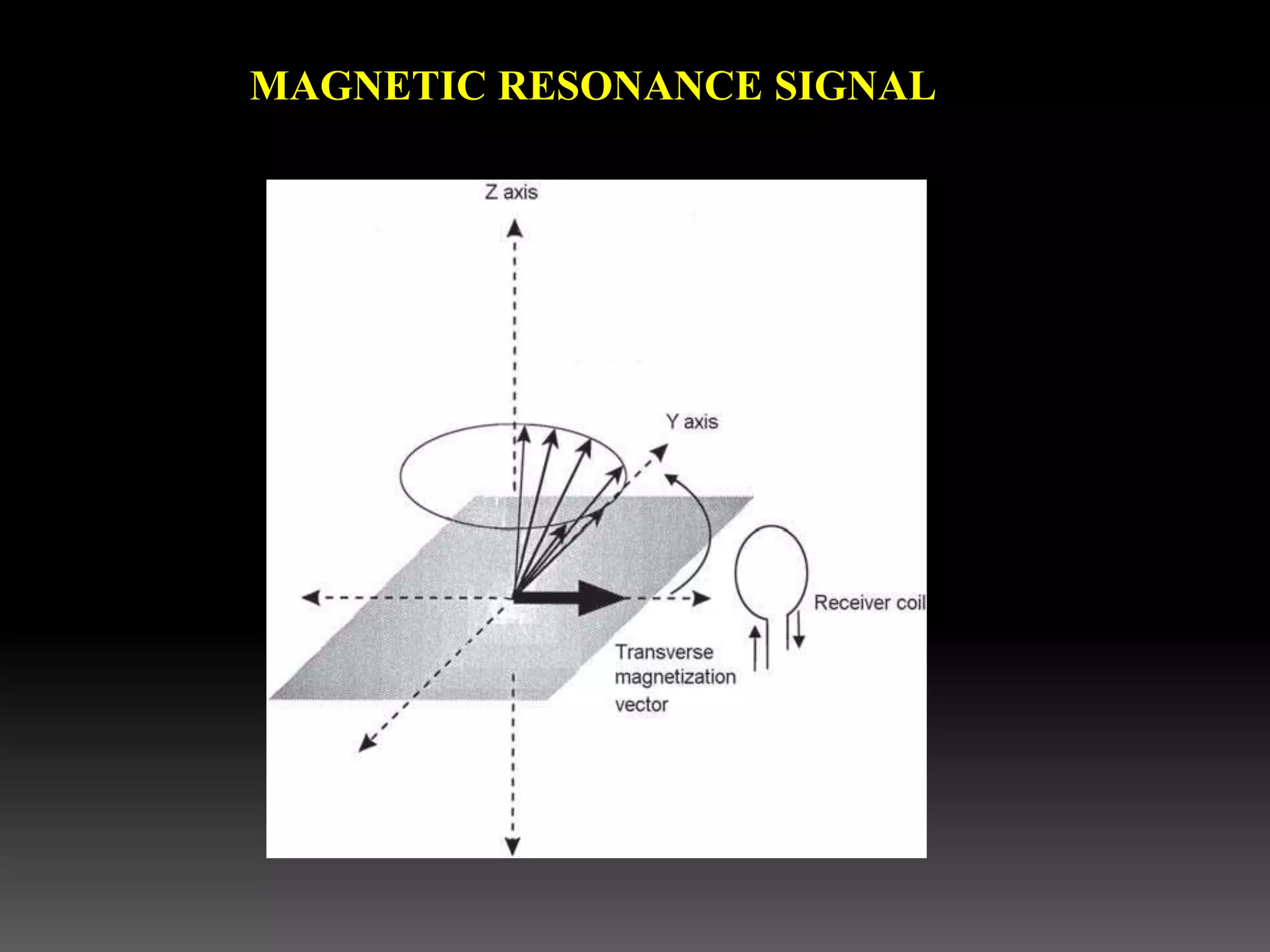 MAGNETIC RESONANCE SIGNAL
 