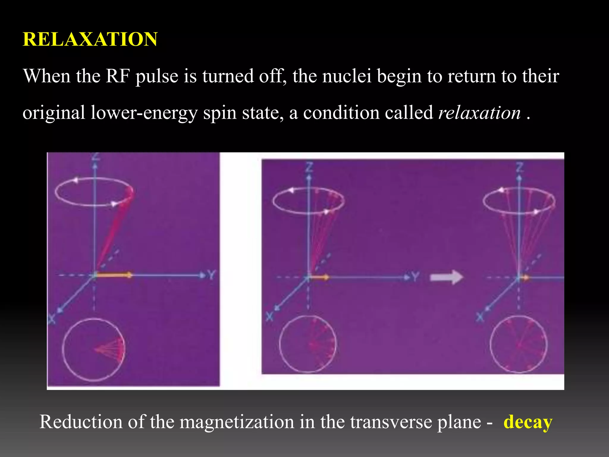 RELAXATION
When the RF pulse is turned off, the nuclei begin to return to their
original lower-energy spin state, a condition called relaxation .
Reduction of the magnetization in the transverse plane - decay
 