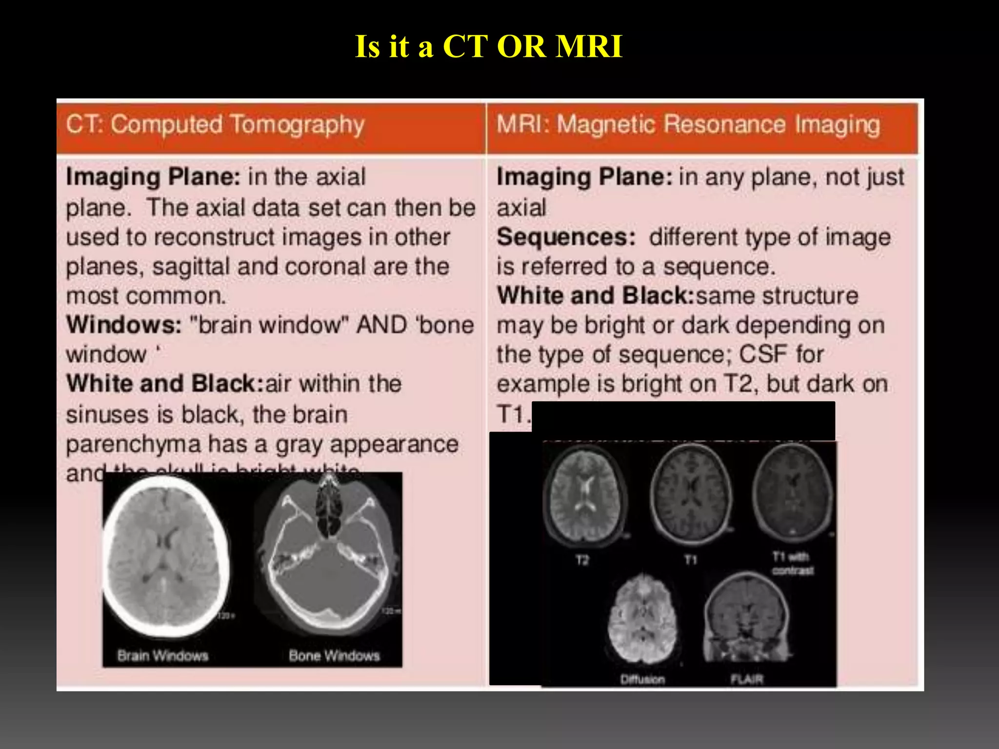 Is it a CT OR MRI
 