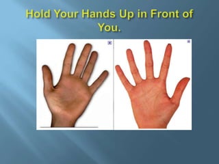 Your right hand is #’s  6 through 10