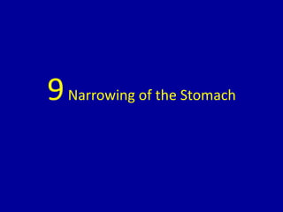 9Narrowing of the Stomach
 