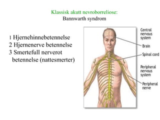 Klassisk akutt nevroborreliose:
Bannwarth syndrom
1 Hjernehinnebetennelse
2 Hjernenerve betennelse
3 Smertefull nerverot
betennelse (nattesmerter)
 