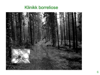 6
Klinikk borreliose
 