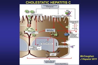 McCaughan
J Hepatol 2011
CHOLESTATIC HEPATITIS C
 