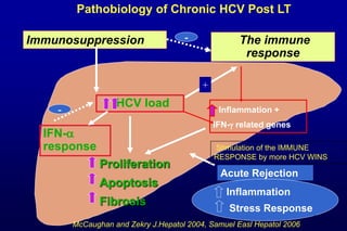 Immunosuppression
Proliferation
Apoptosis
Fibrosis
HCV load Inflammation +
IFN- related genes
IFN-
response
-
Acute Rejection
Inflammation
Stress Response
The immune
response
-
+
Pathobiology of Chronic HCV Post LT
McCaughan and Zekry J.Hepatol 2004, Samuel Easl Hepatol 2006
Stimulation of the IMMUNE
RESPONSE by more HCV WINS
 