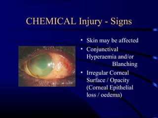 Ocular emergencies | PPT