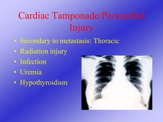Cardiac Tamponade/Pericardial
Injury
• Secondary to metastasis: Thoracic
• Radiation injury
• Infection
• Uremia
• Hypothyroidism
 