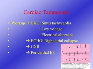 Cardiac Tamponade
• Workup  EKG: Sinus tachycardia
• : Low voltage
• : Electrical alternans
•  ECHO: Right atrial collapse
•  CXR
•  Pericardial Bx
 