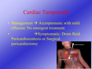 Cardiac Tamponade
• Management  Asymptomatic with mild
effusion: No emergent treatment
• Symptomatic: Drain fluid.
Pericardiocentesis or Surgical
pericardiectomy
 