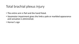 Diminished Hand Sign Orthopedic + erb palsy.pptx