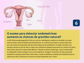 O exame para detectar endometriose
aumenta as chances de gravidez natural?
6
A HSG (histerossalpingografia) é feita em centros radiológicos e avalia se a cavidade e as tubas
uterinas estão comprometidas pela endometriose. As mulheres que fazem o exame costumam
ter mais chance de engravidar até seis meses depois do procedimento. O médico introduz uma
pequena cânula no colo do útero e injeta uma substância radioativa que percorre o interior do útero
e das tubas. Quando as tubas estão abertas, o líquido cai dentro da barriga, o que é comprovado
na radiografia. Nessa avaliação, ocorre uma espécie de “lavagem” do interior da tuba, que pode
desobstruir pequenas aderências. Além disso, a própria substância utilizada traz benefícios para as
células das tubas, facilitando o encontro do espermatozóide com o óvulo.
 