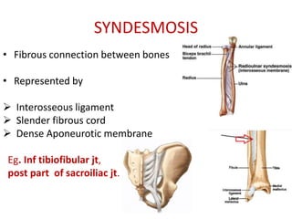 SYNDESMOSIS
• Fibrous connection between bones
• Represented by
 Interosseous ligament
 Slender fibrous cord
 Dense Aponeurotic membrane
Eg. Inf tibiofibular jt,
post part of sacroiliac jt.
 