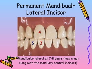 Permanent Mandibualr
Lateral Incisor
• Mandibular lateral at 7-8 years (may erupt
along with the maxillary central incisors)
33
44
55
 