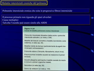 Malattie interstiziali croniche del polmone
Malattie interstiziali croniche del polmone

Polmonite interstiziale cronica che esita in progressiva fibrosi interstiziale
 Polmonite interstiziale cronica che esita in progressiva fibrosi interstiziale

Il processo primario non riguarda gli spazi alveolari
 Il processo primario non riguarda gli spazi alveolari
Cause molteplici
 Cause molteplici
Talvolta l’esordio può essere simile alla ARDS
 Talvolta l’esordio può essere simile alla ARDS
 