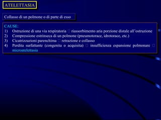 ATELETTASIA
ATELETTASIA

Collasso di un polmone oodi parte di esso
 Collasso di un polmone di parte di esso
CAUSE:
 CAUSE:
1) Ostruzione di una via respiratoria  riassorbimento aria porzione distale all’ostruzione
 1) Ostruzione di una via respiratoria  riassorbimento aria porzione distale all’ostruzione
2) Compressione estrinseca di un polmone (pneumotorace, idrotorace, etc.)
 2) Compressione estrinseca di un polmone (pneumotorace, idrotorace, etc.)
3) Cicatrizzazioni parenchima  retrazione eecollasso
 3) Cicatrizzazioni parenchima  retrazione collasso
4) Perdita surfattante (congenita oo acquisita)  insufficienza espansione polmonare 
 4) Perdita surfattante (congenita acquisita)  insufficienza espansione polmonare 
    microatelettasia
    microatelettasia
 
