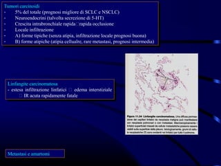 Tumori carcinoidi
 Tumori carcinoidi
--  5% del totale (prognosi migliore di SCLC eeNSCLC)
     5% del totale (prognosi migliore di SCLC NSCLC)
--  Neuroendocrini (talvolta secrezione di 5-HT)
     Neuroendocrini (talvolta secrezione di 5-HT)
--  Crescita intrabronchiale rapidarapida occlusione
     Crescita intrabronchiale rapidarapida occlusione
--  Locale infiltrazione
     Locale infiltrazione
--  A) forme tipiche (senza atipia, infiltrazione locale prognosi buona)
     A) forme tipiche (senza atipia, infiltrazione locale prognosi buona)
--  B) forme atipiche (atipia cellualre, rare metastasi, prognosi intermedia)
     B) forme atipiche (atipia cellualre, rare metastasi, prognosi intermedia)




 Linfangite carcinomatosa
   Linfangite carcinomatosa
 - - estesa infiltrazione linfatici  edema interstiziale
      estesa infiltrazione linfatici  edema interstiziale
          IR acuta rapidamente fatale
           IR acuta rapidamente fatale




 Metastasi eeamartomi
 Metastasi amartomi
 