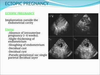Sluffing Utrius Obstetrics Role of Imaging in Obs.(1).ppt